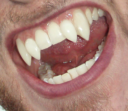 Cm-Fg-ScWf107__Werewolf_Fangs_as_Shredders.jpg