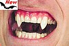 Classic Custom Fangs