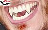 Werewolf Fangs