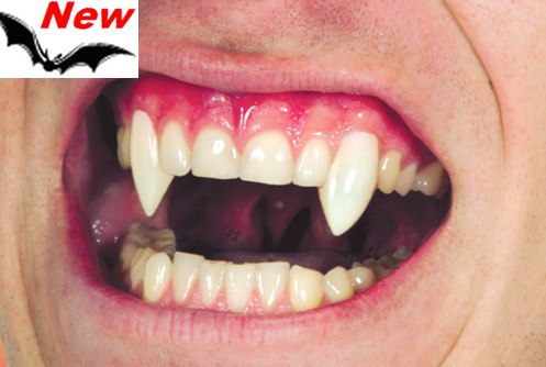 Fangs